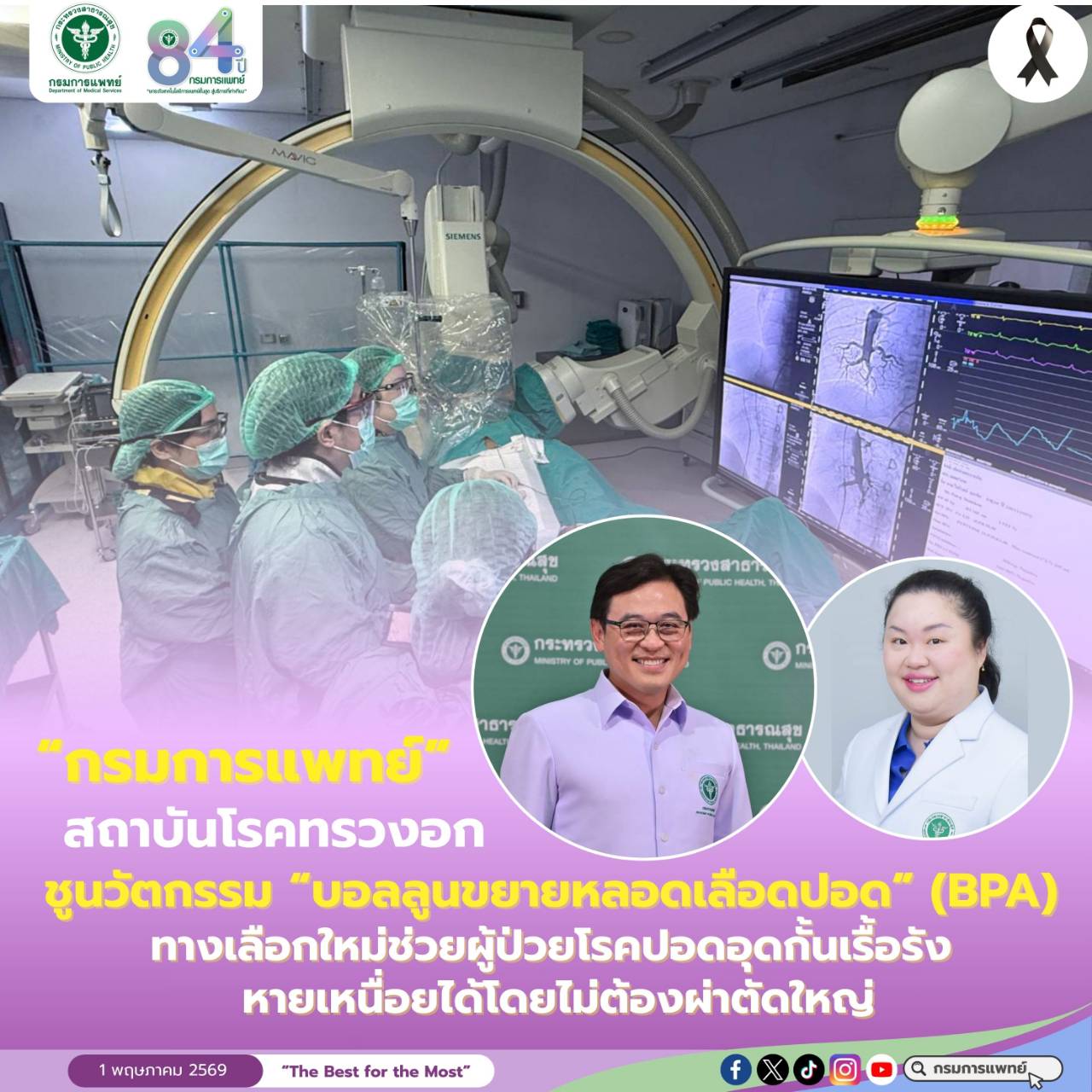 สถาบันโรคทรวงอกชูนวัตกรรม “บอลลูนขยายหลอดเลือดปอด” (BPA) ทางเลือกใหม่ช่วยผู้ป่วยโรคปอดอุดกั้นเรื้อรัง หายเหนื่อยได้โดยไม่ต้องผ่าตัดใหญ่