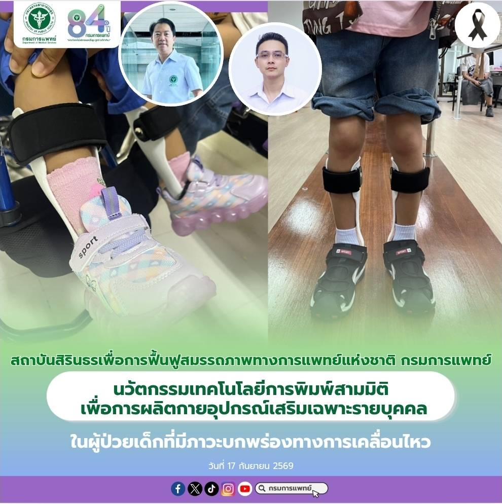 นวัตกรรมเทคโนโลยีการพิมพ์สามมิติ เพื่อการผลิตกายอุปกรณ์เสริมเฉพาะรายบุคคล ในผู้ป่วยเด็กที่มีภาวะบกพร่องทางการเคลื่อนไหว