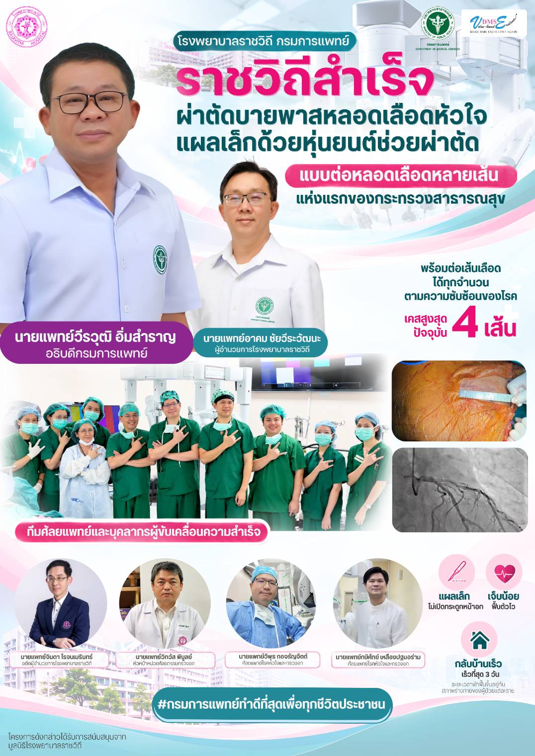 โรงพยาบาลราชวิถีประสบความสำเร็จในการผ่าตัดบายพาสหลอดเลือดหัวใจแผลเล็ก ด้วยหุ่นยนต์ช่วยผ่าตัด แบบต่อหลายเส้นเป็นแห่งแรกของกระทรวงสาธารณสุข